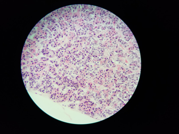 Pituitary Gland Slides - Pituitary Gland 016 400X